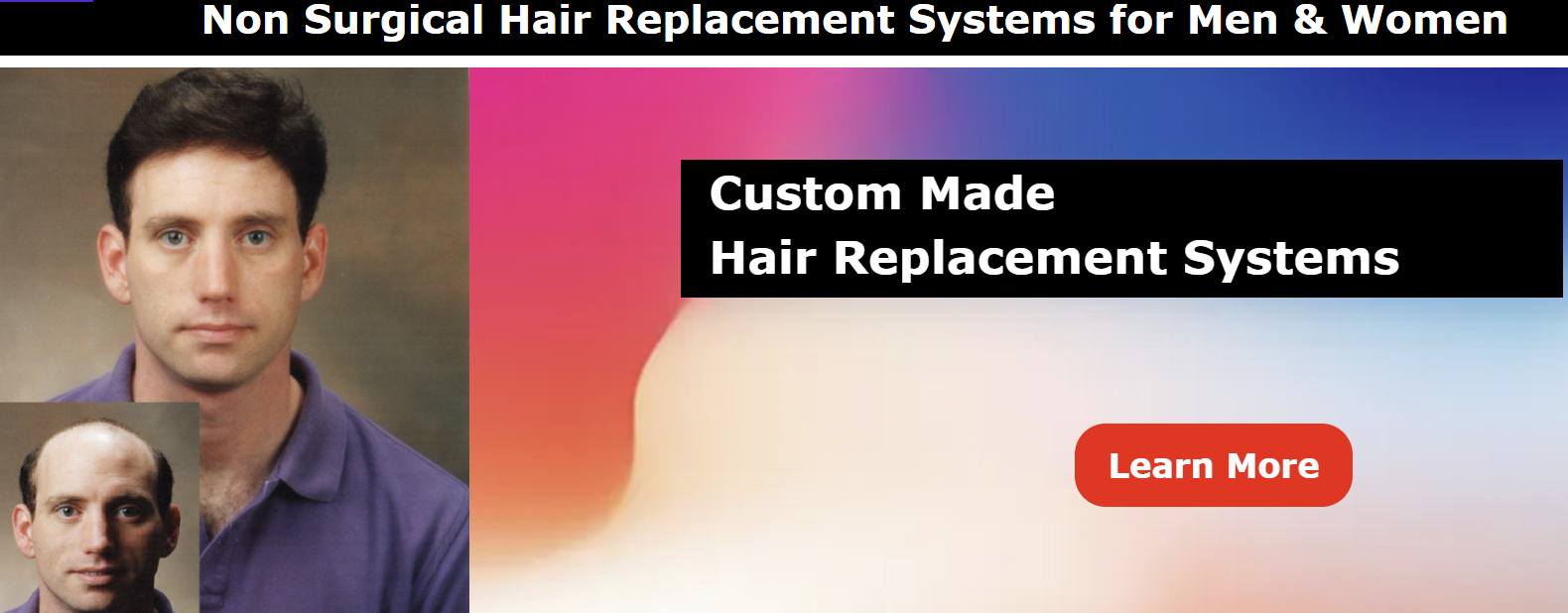 Custom Hair System - Click Image to Close